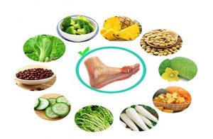 Chế độ dinh dưỡng trong điều trị bệnh gút